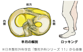 ※日本整形外科学会「整形外科シリーズ 11」から画像