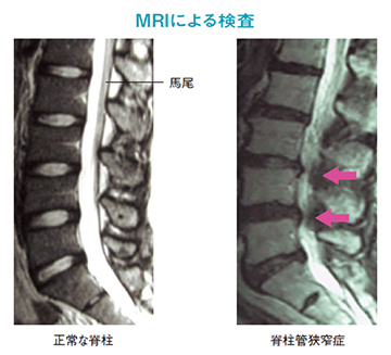 MRIによる検査写真